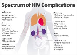 HIV